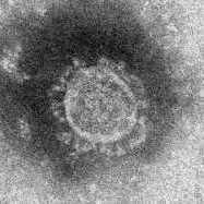 新型コロナウイルスとインフルエンザ
